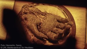 Die  Schwarze Hand von Bödefeld